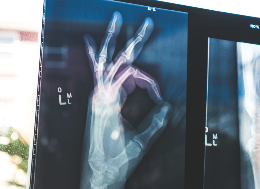 Get more confident when giving presentations: X-ray of hand showing all is okay gesture